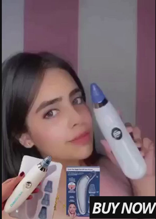 Powerful Blackhead & Pimple Remover Vacuum | Rechargeable Pore Cleansing Suction Device | Best for Clear Skin